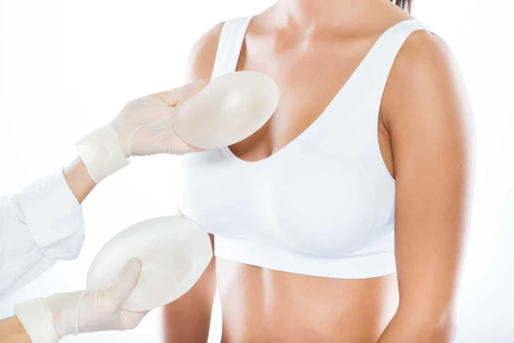 Breast Augmentation: Breast Implants vs. Fat Grafting