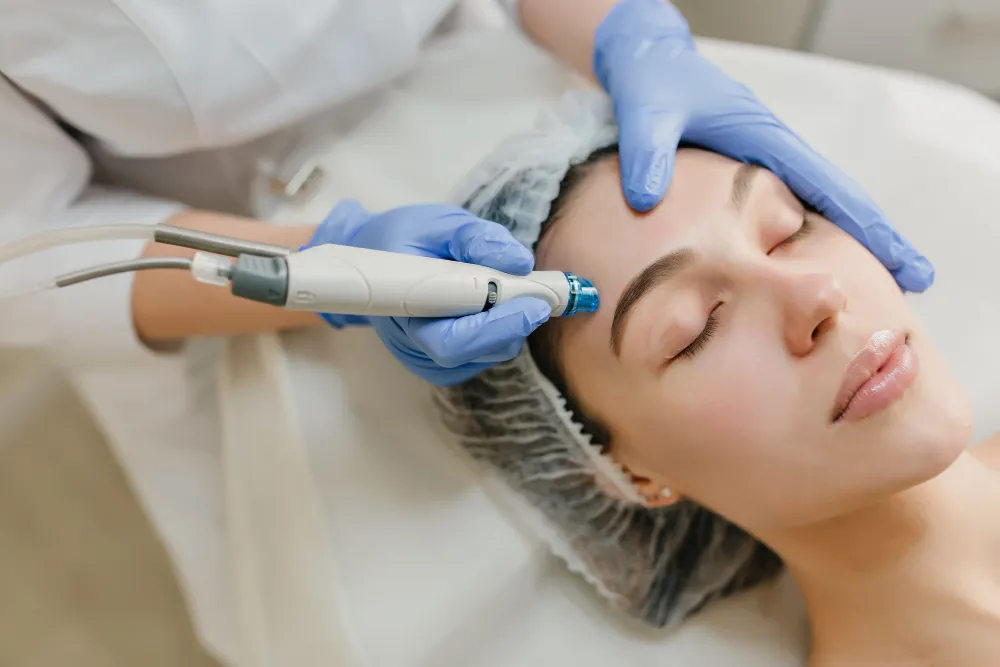 Glow Beyond Acne Mastering Radiance with Laser Treatment