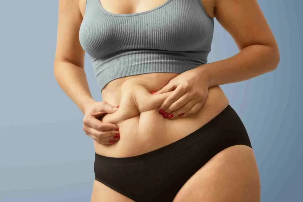 How Liposuction Works When Diet and Exercise Fail