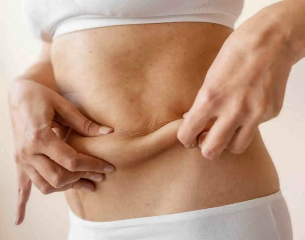 Tummy Tuck Recovery – What to Expect